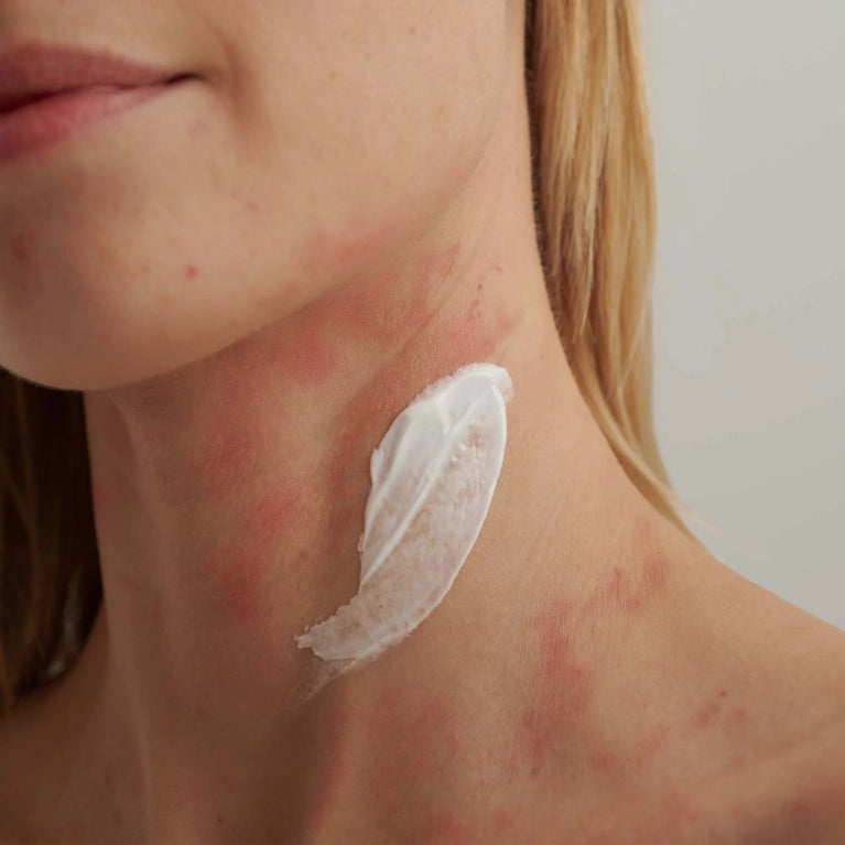 Extroderm intensive cream