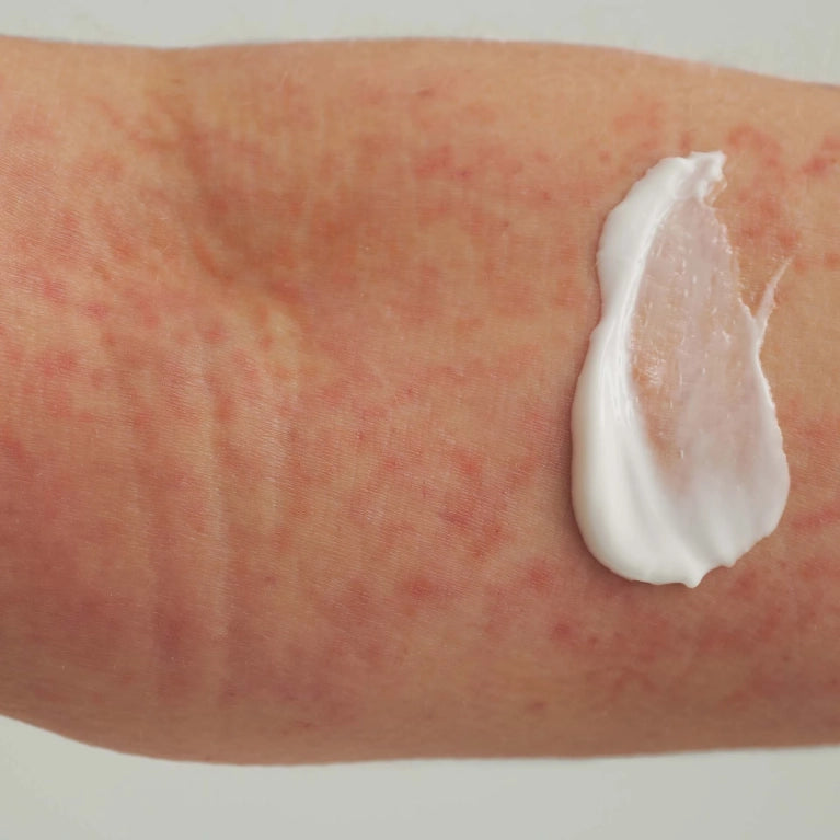 Extroderm skin balm