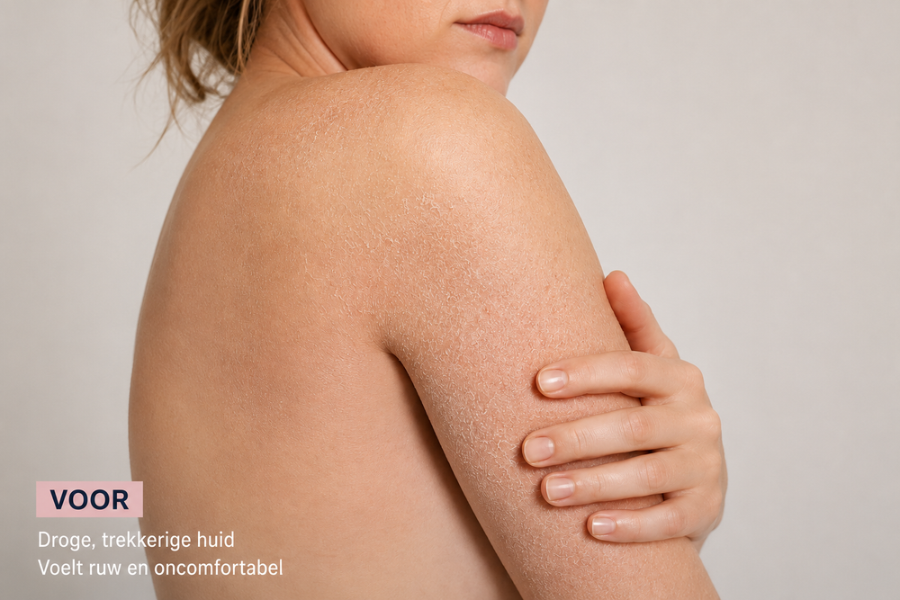 Extroderm Douchecrème – Voor: Sandra