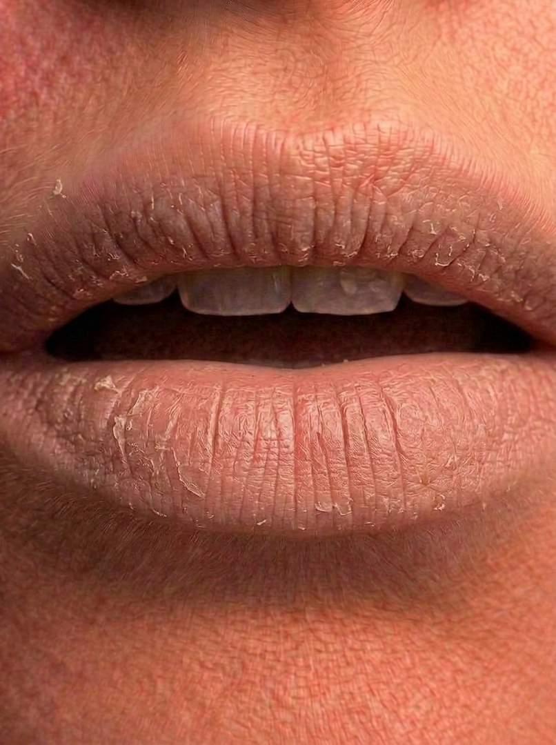 Hypersensitive Color Lipcare Nude – voor-foto review Nora