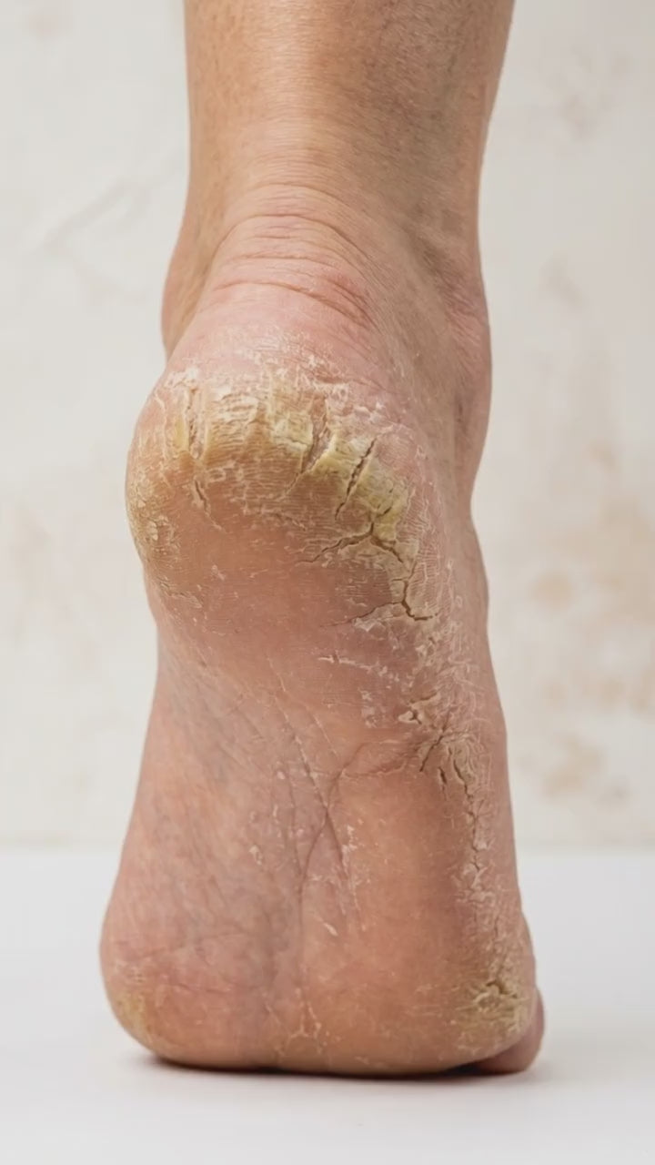 Load video: Footcare Callus Balm – Dado Sens